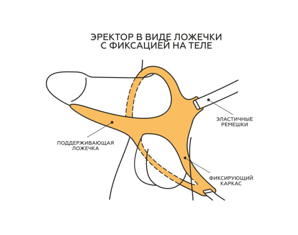 Эректор - полужесткая поддерживающая ложечка с фиксацией в ламинате l 110 мм d 45 мм, арт. 752400_5